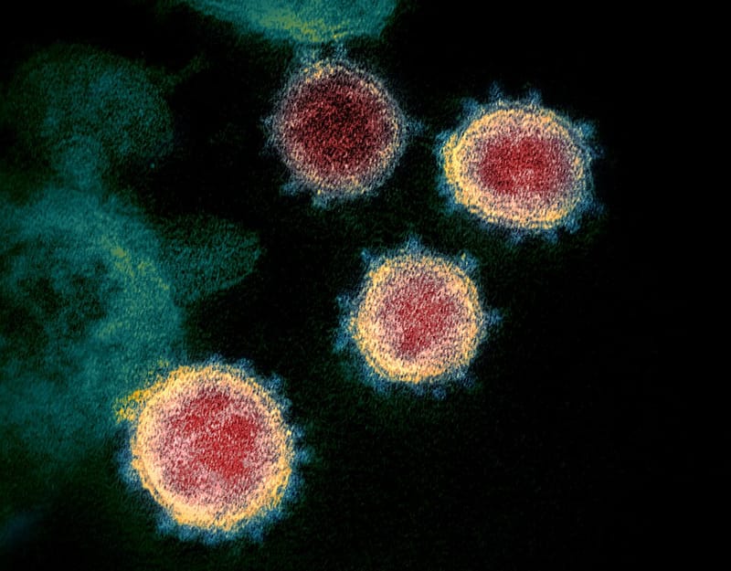 Electron microscope image of the SARS-CoV-2 virus that causes COVID-19